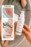 Diaper Rash Cream for Babies