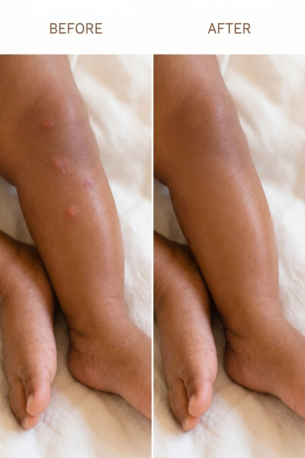 Gentle Baby Mosquito Repellent Cream